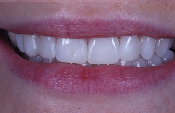 face - haymarketdentalnew