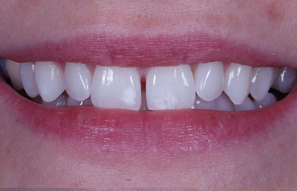 face - haymarketdentalnew