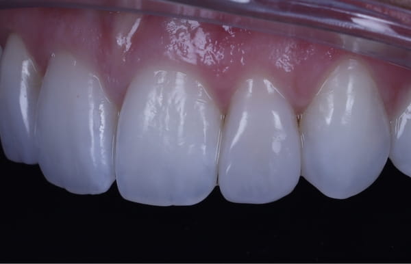 face - haymarketdentalnew