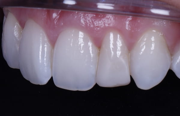 face - haymarketdentalnew