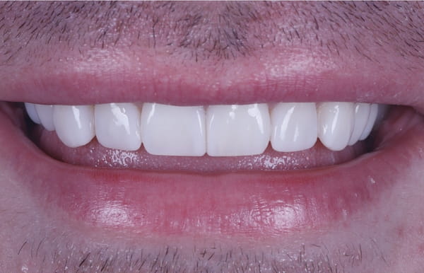 face - haymarketdentalnew