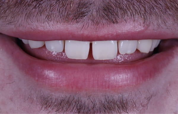 face - haymarketdentalnew