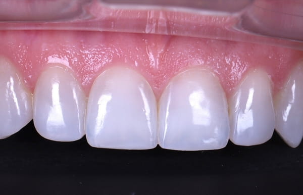 face - haymarketdentalnew