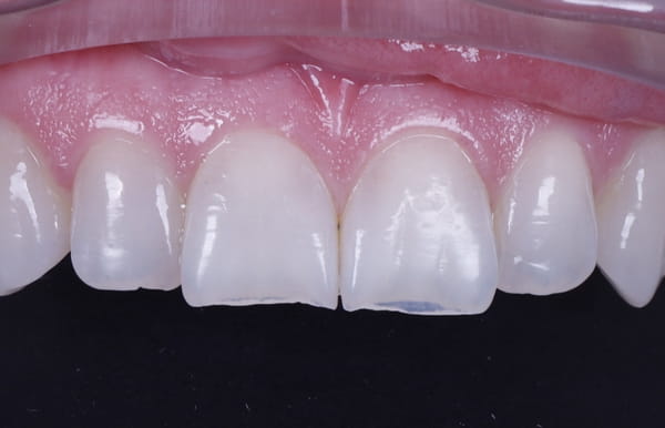 face - haymarketdentalnew