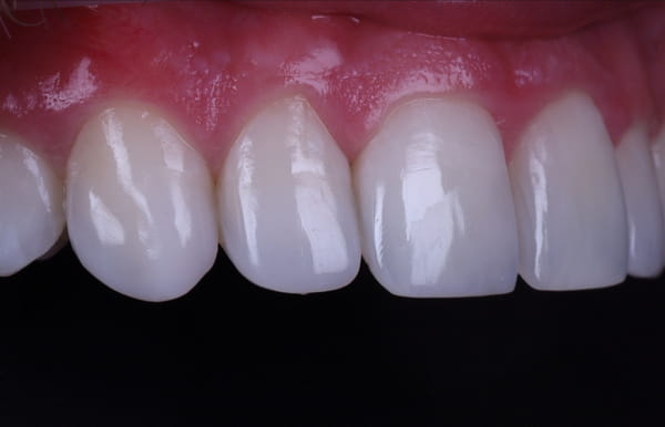 face - haymarketdentalnew