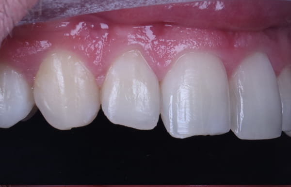 face - haymarketdentalnew