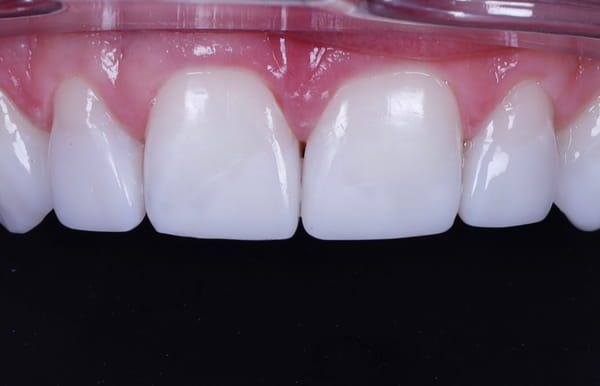 face - haymarketdentalnew