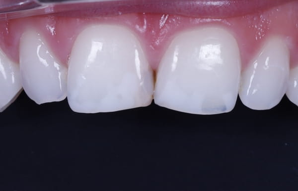 face - haymarketdentalnew