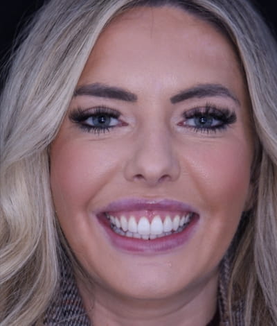 face - haymarketdentalnew