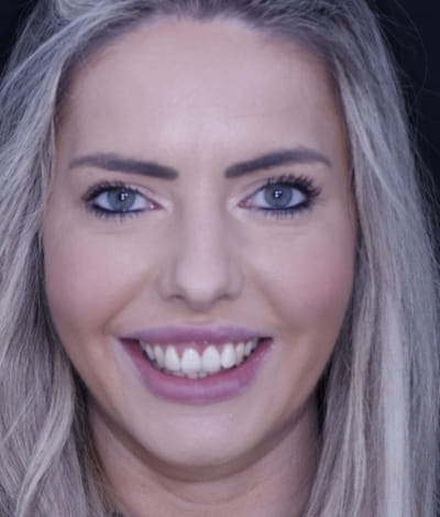 face - haymarketdentalnew