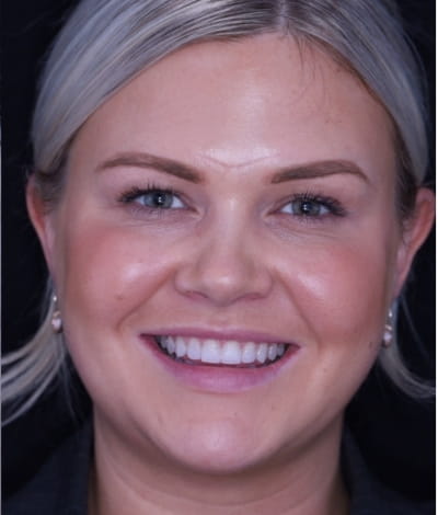 face - haymarketdentalnew