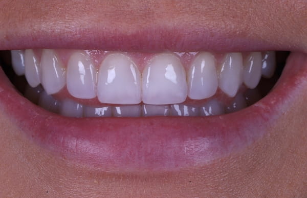 face - haymarketdentalnew