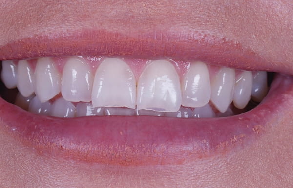 face - haymarketdentalnew