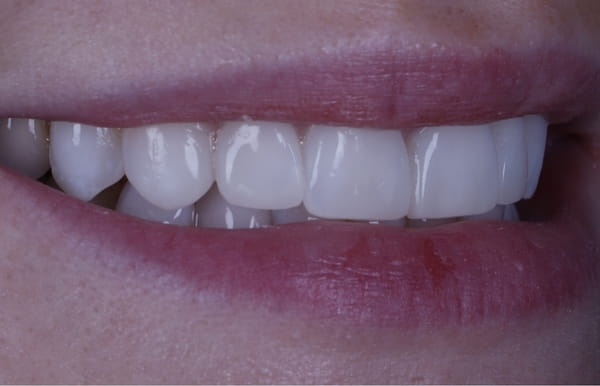 face - haymarketdentalnew