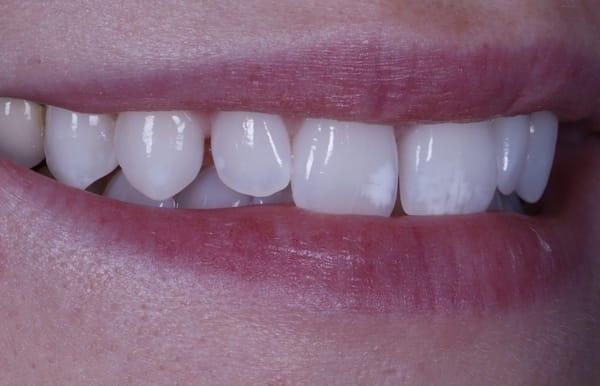 face - haymarketdentalnew
