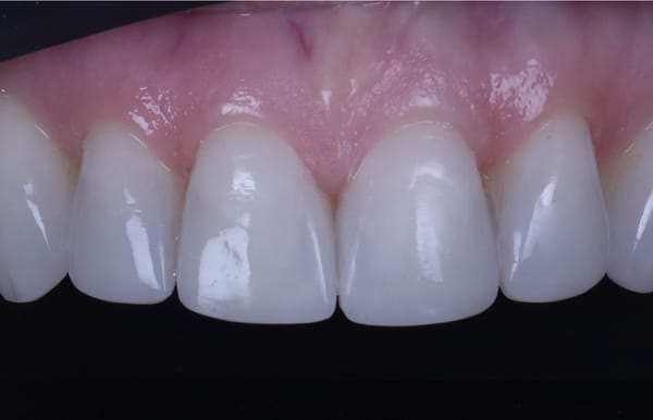 face - haymarketdentalnew