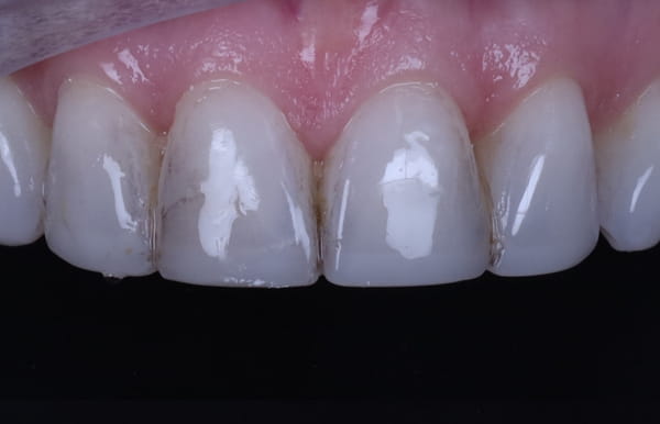 face - haymarketdentalnew