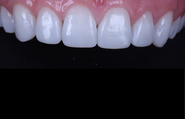 face - haymarketdentalnew