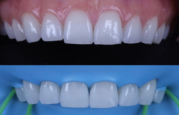 face - haymarketdentalnew