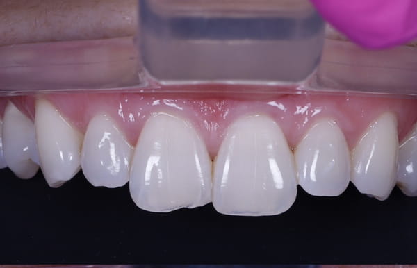face - haymarketdentalnew