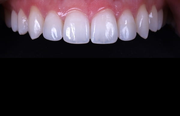 face - haymarketdentalnew