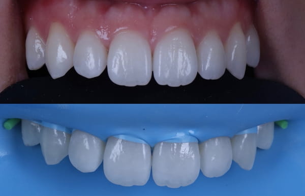 face - haymarketdentalnew