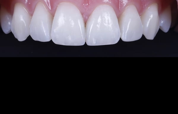face - haymarketdentalnew