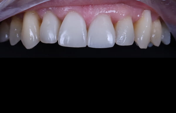 face - haymarketdentalnew