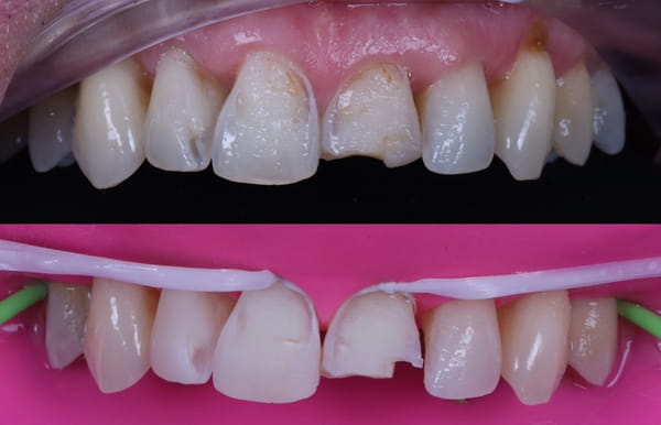 face - haymarketdentalnew