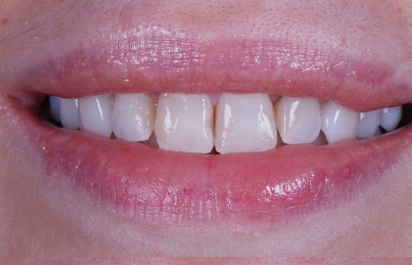 face - haymarketdentalnew