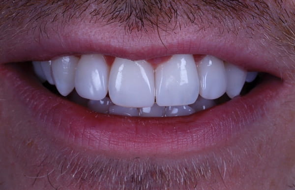 face - haymarketdentalnew