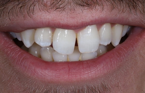 face - haymarketdentalnew