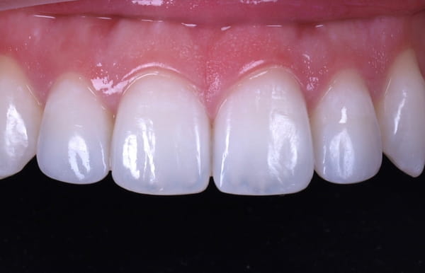 face - haymarketdentalnew