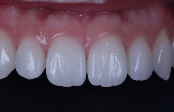 face - haymarketdentalnew