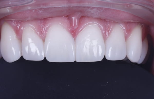face - haymarketdentalnew