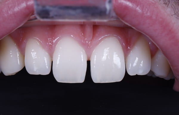 face - haymarketdentalnew