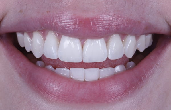 face - haymarketdentalnew