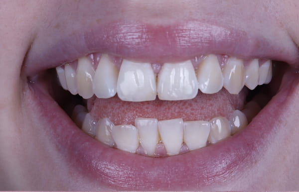 face - haymarketdentalnew