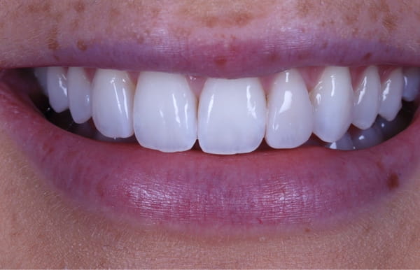 face - haymarketdentalnew