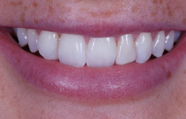 face - haymarketdentalnew