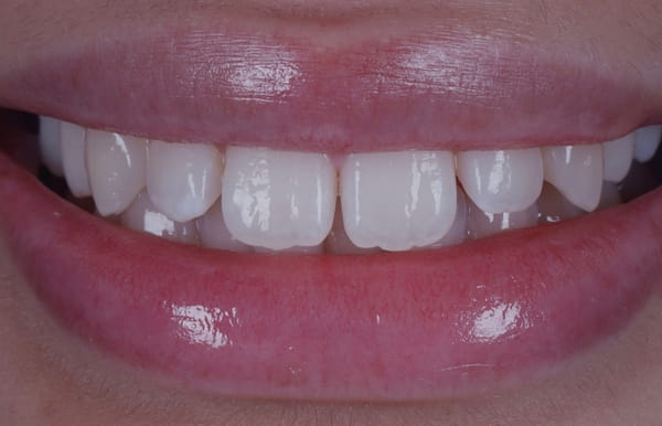face - haymarketdentalnew