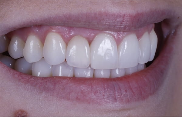 face - haymarketdentalnew
