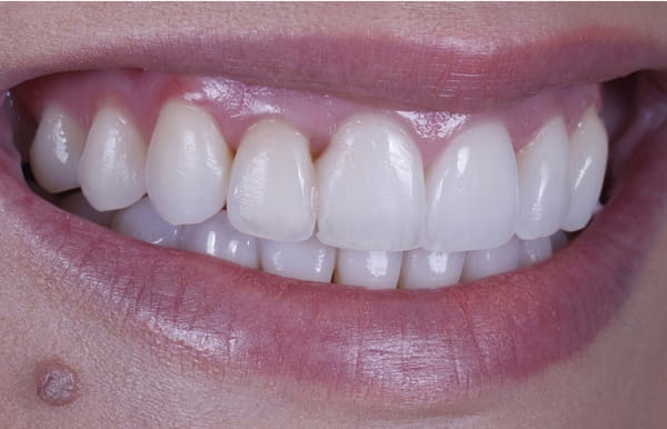 face - haymarketdentalnew
