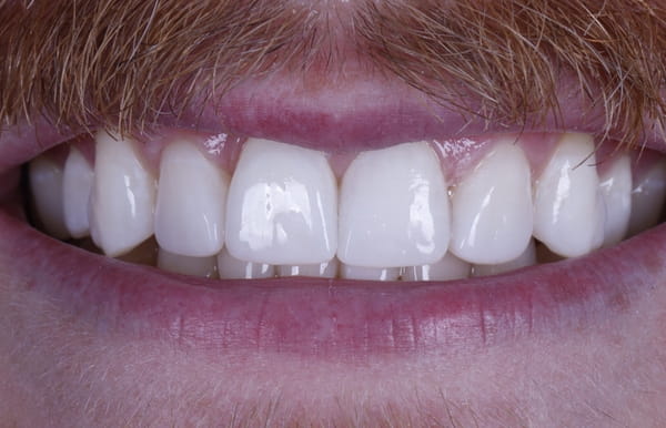 face - haymarketdentalnew