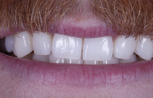 face - haymarketdentalnew