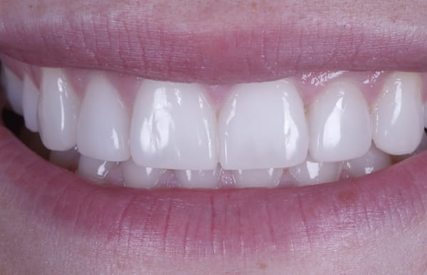 face - haymarketdentalnew