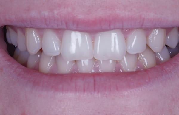 face - haymarketdentalnew