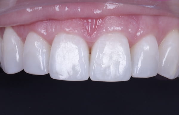 face - haymarketdentalnew
