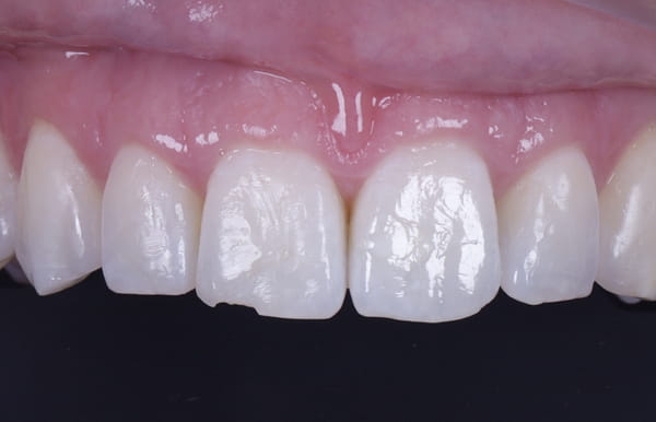 face - haymarketdentalnew