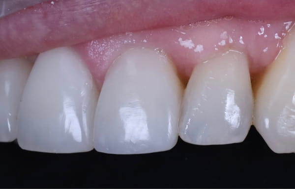 face - haymarketdentalnew